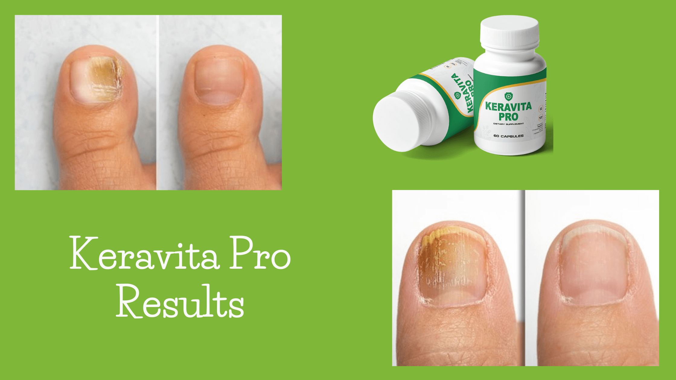 Keravita Pro Results