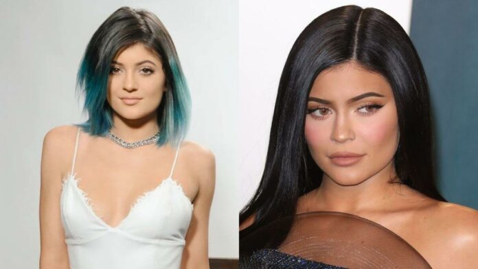 Kylie Jenner Before And After Plastic Surgery Journey