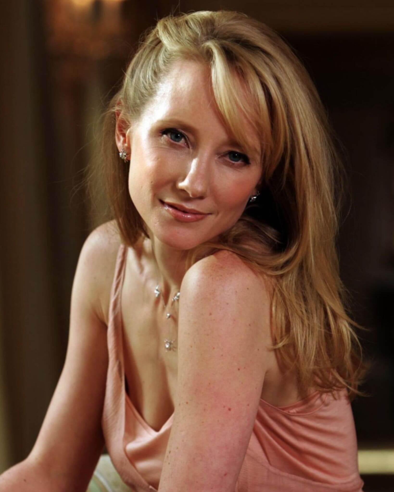 Anne Heche 'IS NOT EXPECTED TO SURVIVE'
