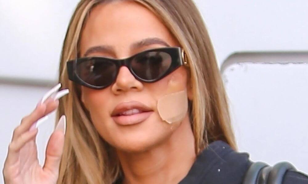 Khloe Kardashian Details Her Skin Cancer Scare After Getting A Tumor Removed From Face